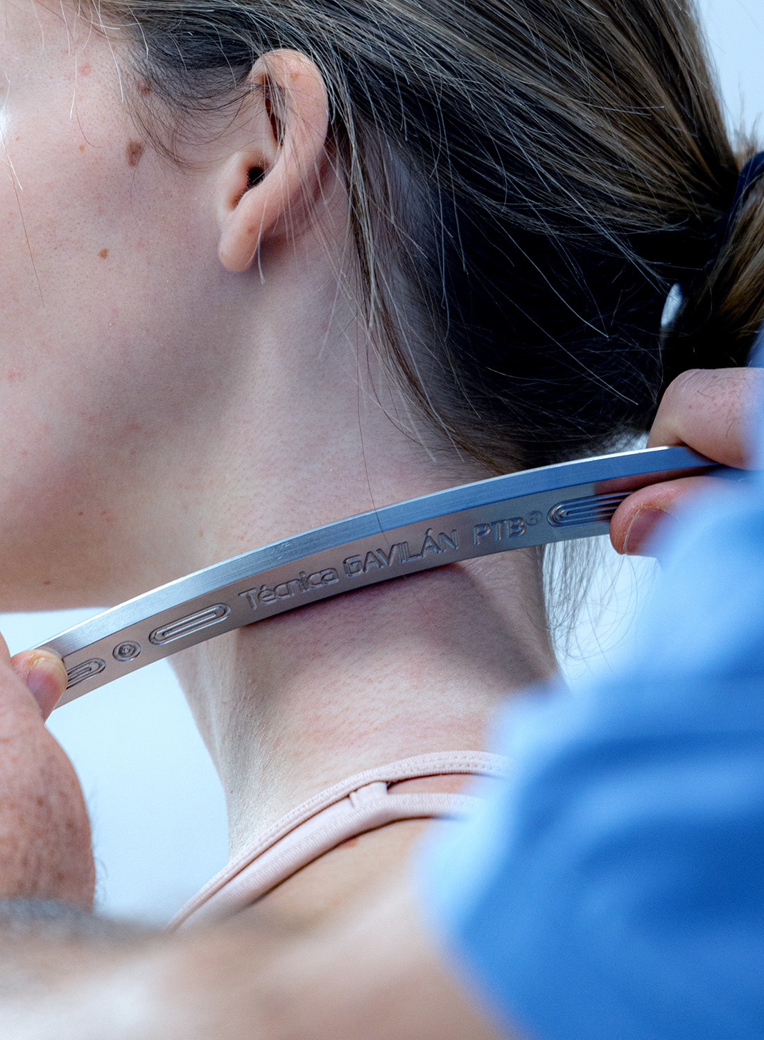 Applicazione della tecnica Gavilán con strumenti IASTM in acciaio per liberare aderenze fasciali e migliorare la mobilità